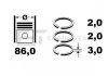 Комплект кілець на поршень (на всі поршні) ET ENGINETEAM R4000900 (фото 2)