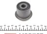 Сайлентблок важеля SMART FORTWO, CITY-COUPE 98- передній міст низ MEYLE 014 610 0015 (фото 2)